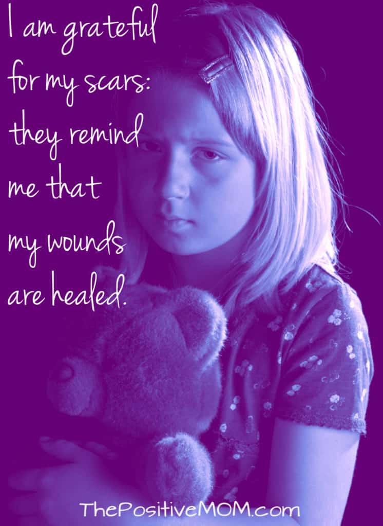 I am grateful for my scars because they remind me my wounds are healed ~ Elayna Fernandez - The Positive Mom